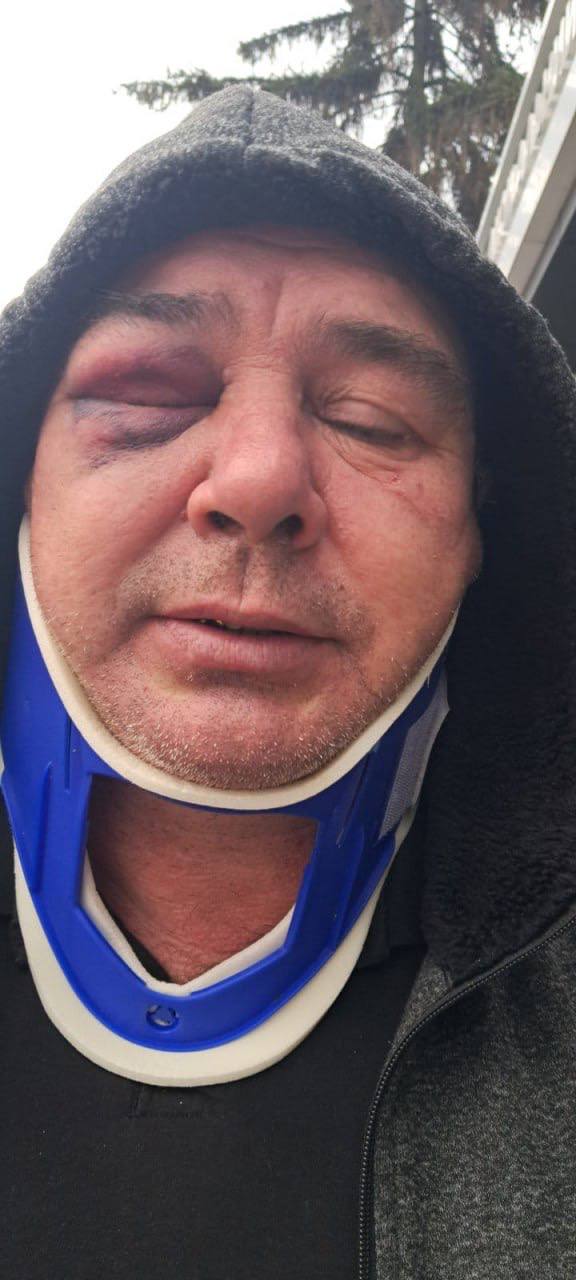 Под Киевом военкомы выволокли 55-летнего водителя и избили до полусмерти на глазах у полицаев