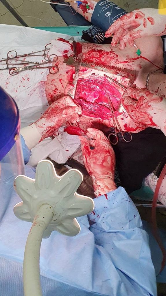 Вернули с того света: Уникальная операция военных медиков