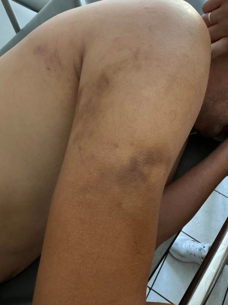 Плакал и вопил, что ему нужно в Польшу за машинами для ВСУ: В Ровно военного волонтера поймали и пытали в ТЦК после возвращения с фронта