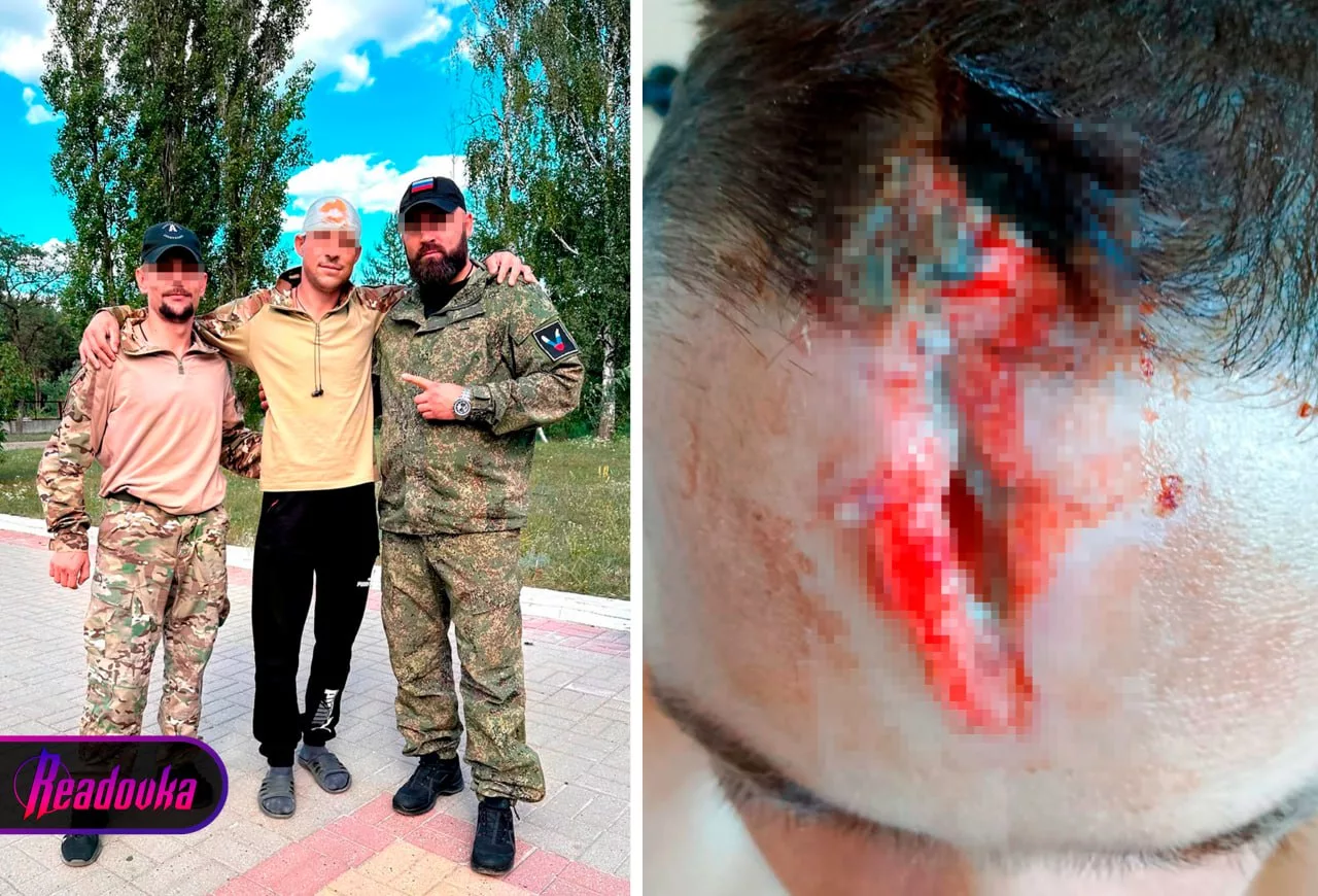 Стало известно имя бесстрашного бойца, отбившего дрон головой — герой нашумевшего видео ждет операции на позвоночнике и рвется обратно в бой