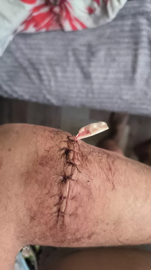 Отморозки с молотками напали на участника СВО в собственной квартире: он дал отпор подонкам и ему грозит срок за самооборону