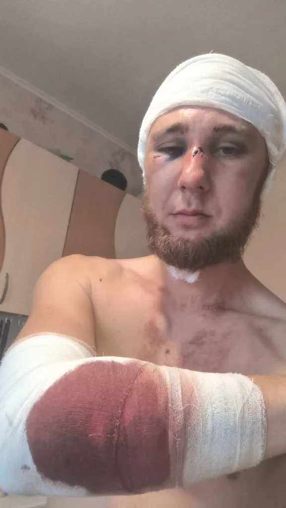 Отморозки с молотками напали на участника СВО в собственной квартире: он дал отпор подонкам и ему грозит срок за самооборону