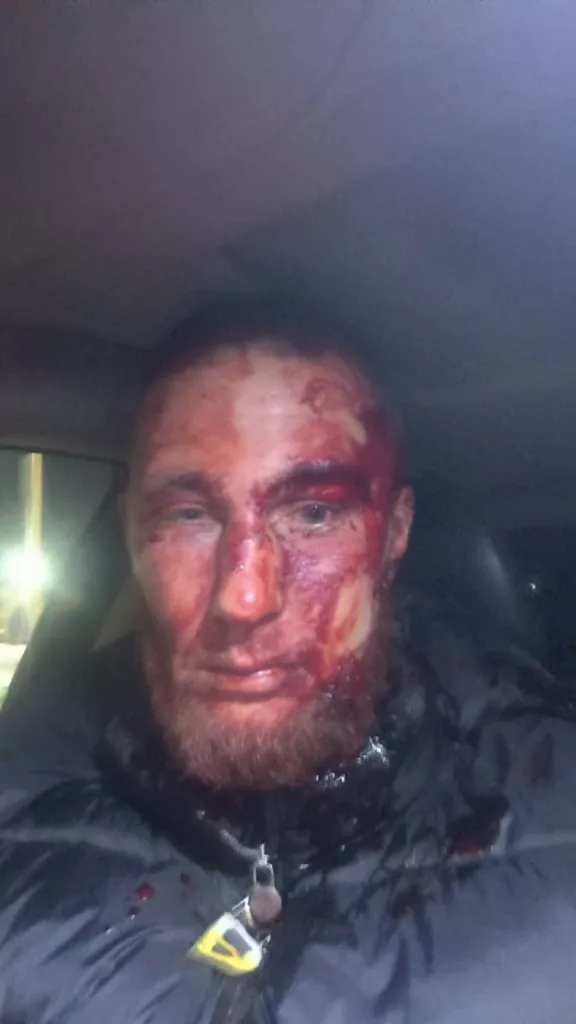 Отморозки с молотками напали на участника СВО в собственной квартире: он дал отпор подонкам и ему грозит срок за самооборону