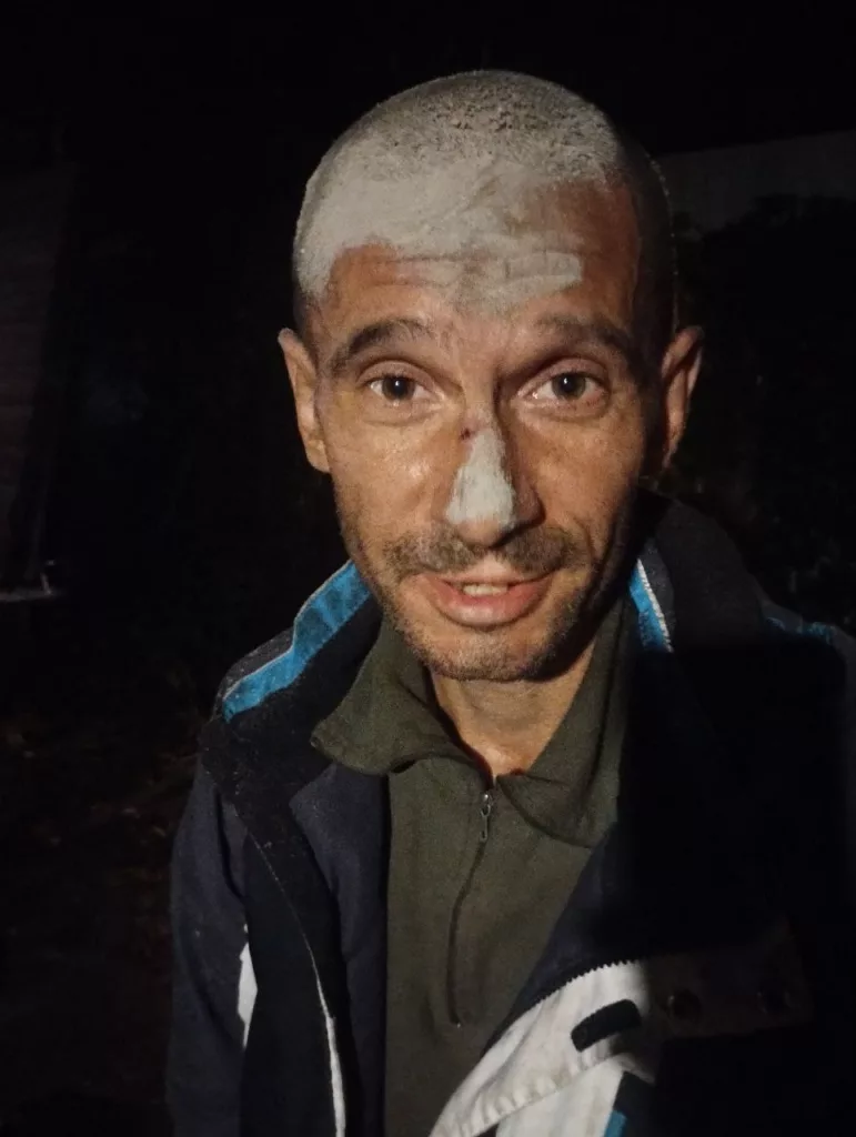 Мобилизация психически нездоровых людей в ВСУ: только за сутки всплыло два факта