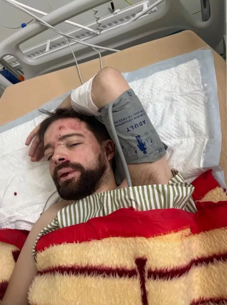 Преподавателя львовского университета нашли на обочине с отёком мозга, переломом черепа и гематомами. Вчера его по пути на работу забрали сотрудники ТЦК