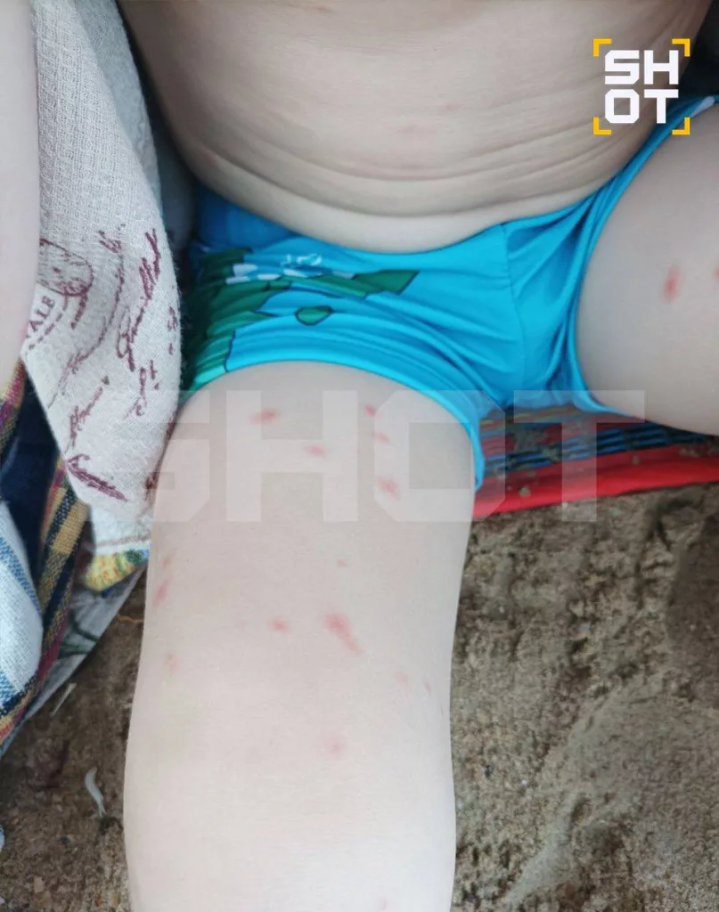 Российские туристы массово заражаются лихорадкой денге и в Таиланде