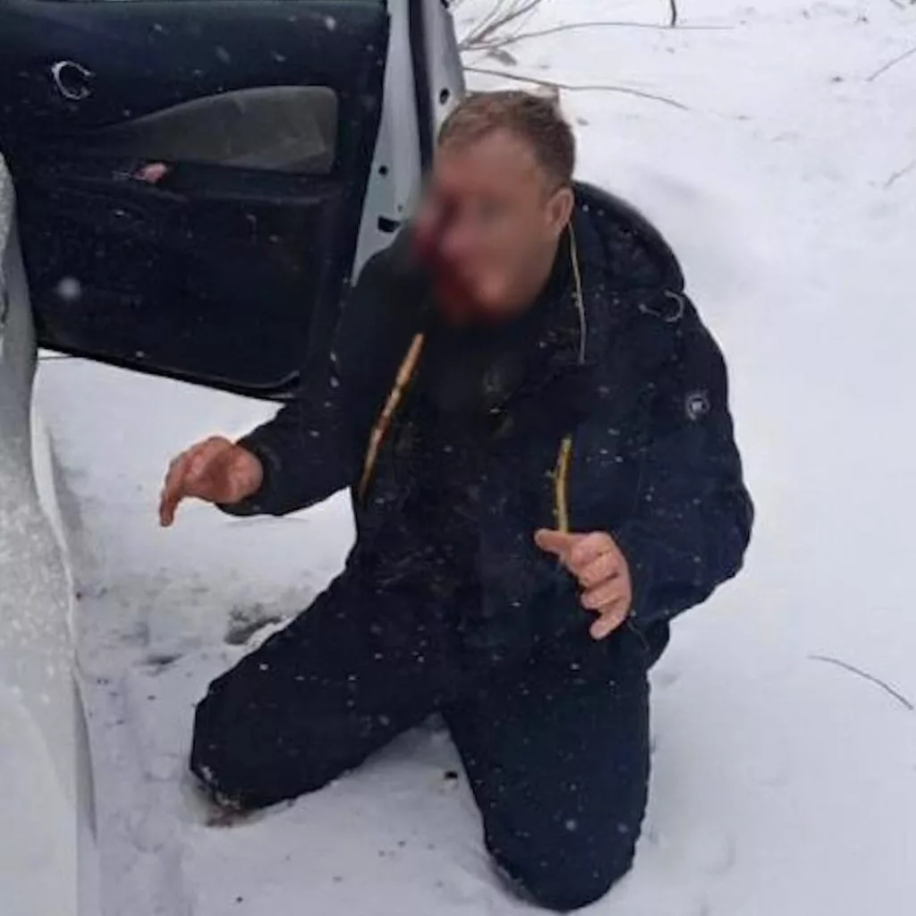В больнице умер предполагаемый убийца алтайского чиновника, сообщили "Звезде" в пресс-службе местного СК