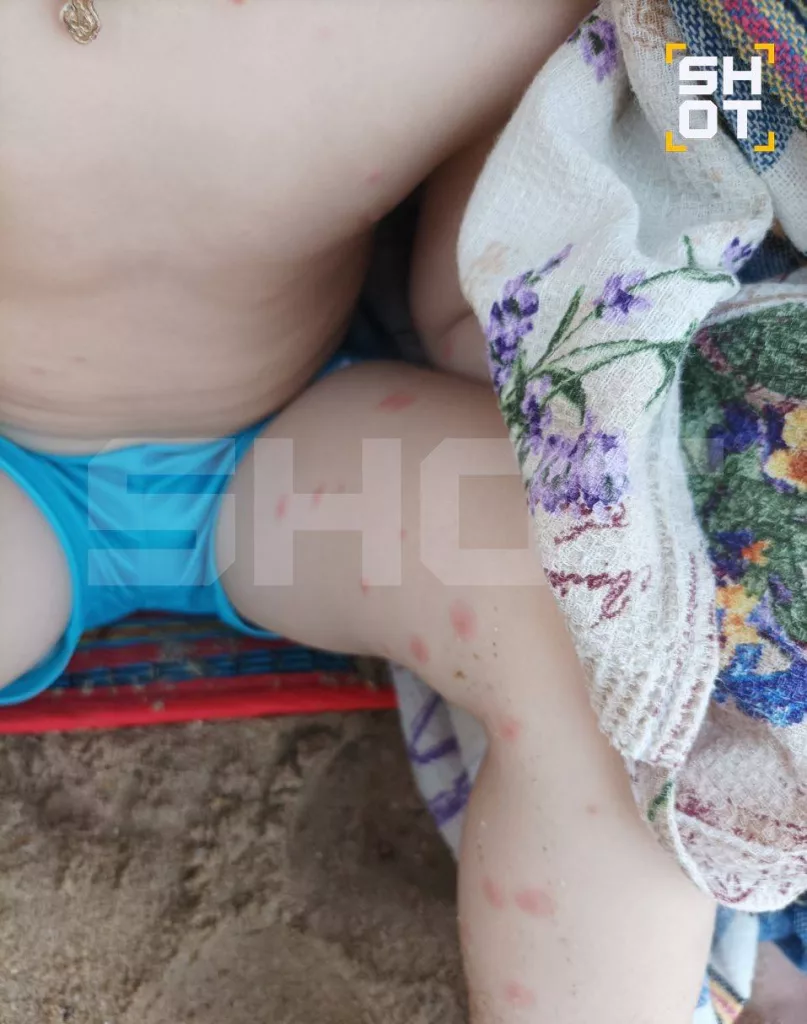 Российские туристы массово заражаются лихорадкой денге и в Таиланде