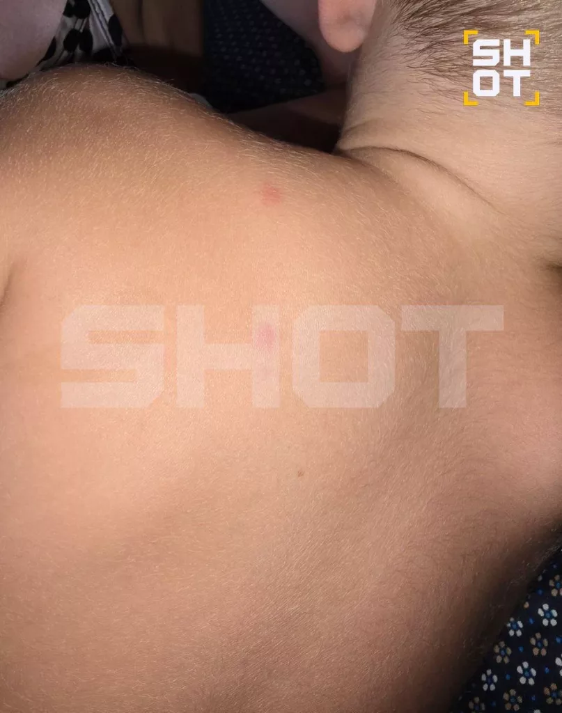 Российские туристы массово заражаются лихорадкой денге и в Таиланде