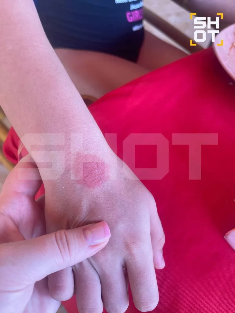 Российские туристы массово заражаются лихорадкой денге и в Таиланде