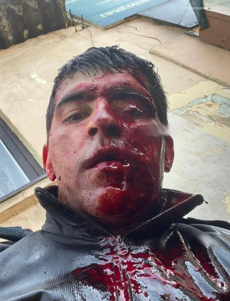 Один из дагестанских полицейских, получивших тяжелое ранение при перестрелке в Махачкале, сумел ликвидировать нападавшего ножом, выхваченным у него же в ходе борьбы
