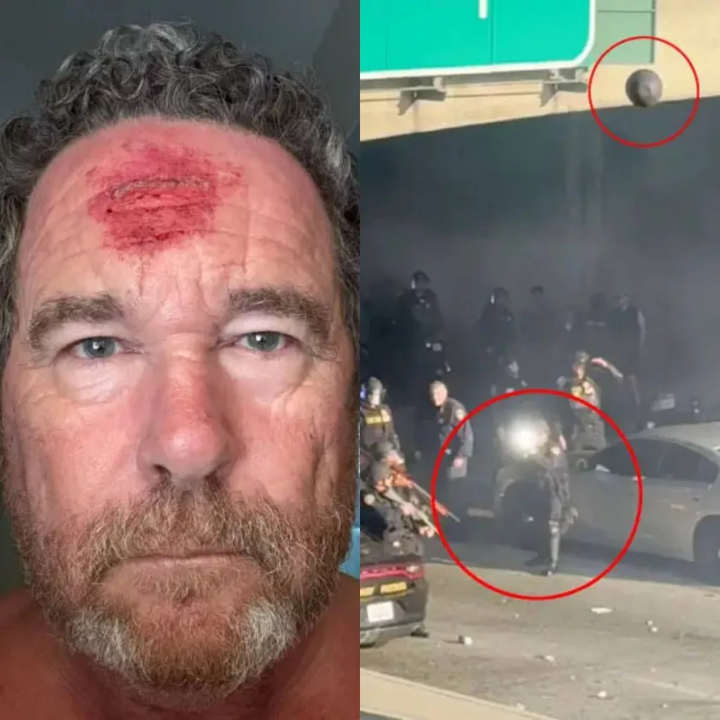 Фотографу New York Post выстрелили в голову резиновой пулей во время протестов в Лос-Анджелесе