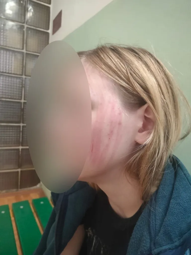 Не оплатил проезд — получи по голове: Во Ржеве водитель автобуса избил 14-летнюю девочку