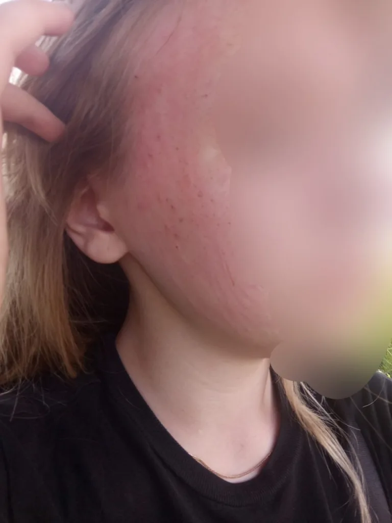 Не оплатил проезд — получи по голове: Во Ржеве водитель автобуса избил 14-летнюю девочку