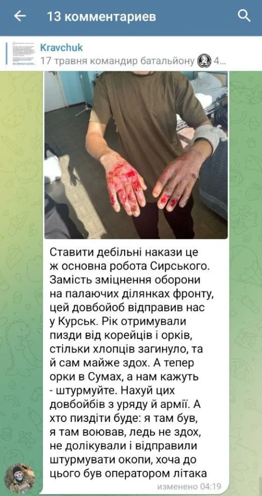 Сумская область, место лечения ВСУшников