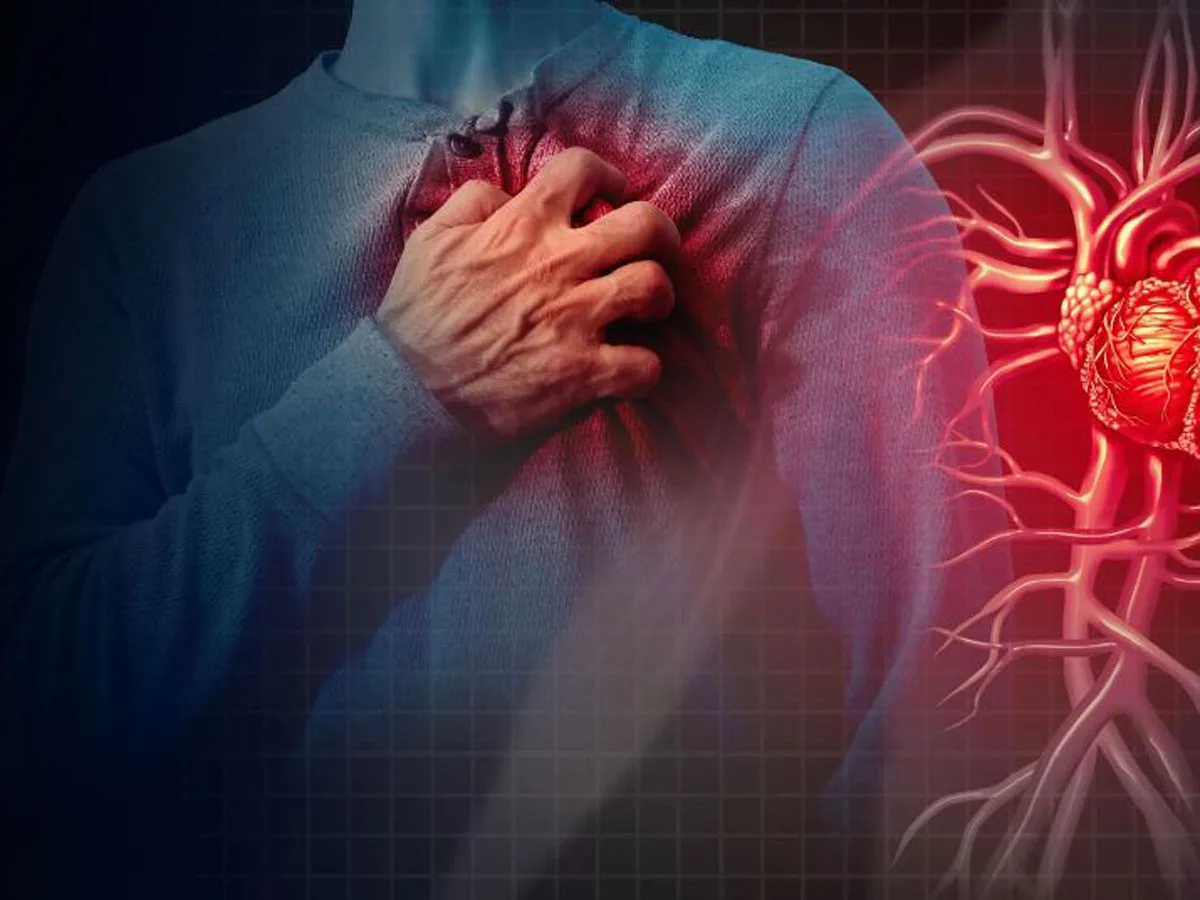 Медики выяснили причину быстрого образования бляшек в сосудах0