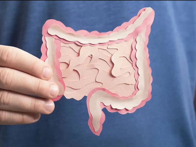 Медики определили наиболее вероятную причину возникновения рака кишечника у молодежи0