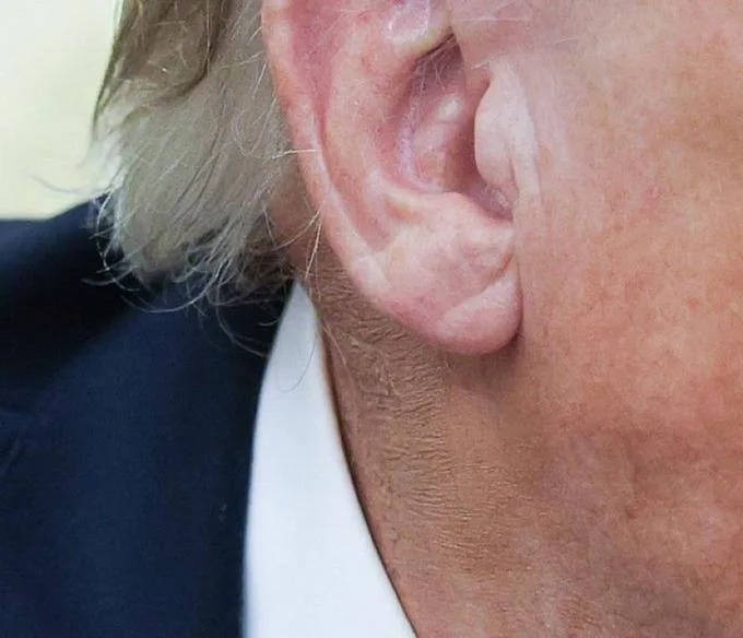 Трамп смертельно болен: так снова считают американские СМИ