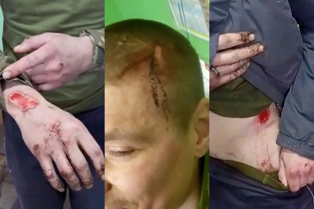 Добро пожаловать в штурмовой полк украинских смертников «Скала» ВСУ, где с новобранцами творят страшное