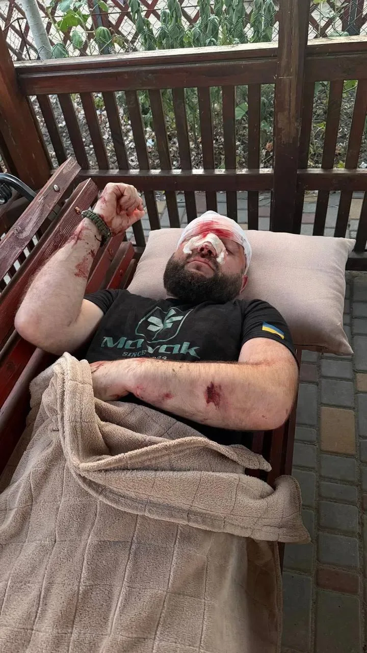 Прекрасное из Одесской области. Укровояка в одном из кафе в Затоке решил объяснить окружающим, что слушать музыку на русском языке нельзя