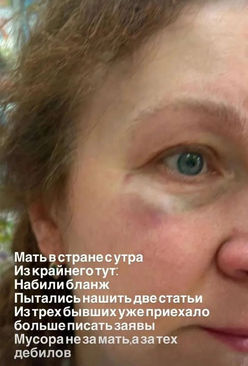 Типичная Украина. Мать украинского военного избили и высадили из автобуса из-за русского языка